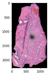 _images/histology-prototype-001-1-final.jpeg