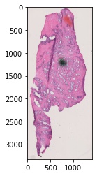 _images/histology-prototype-001-1-raw.jpeg